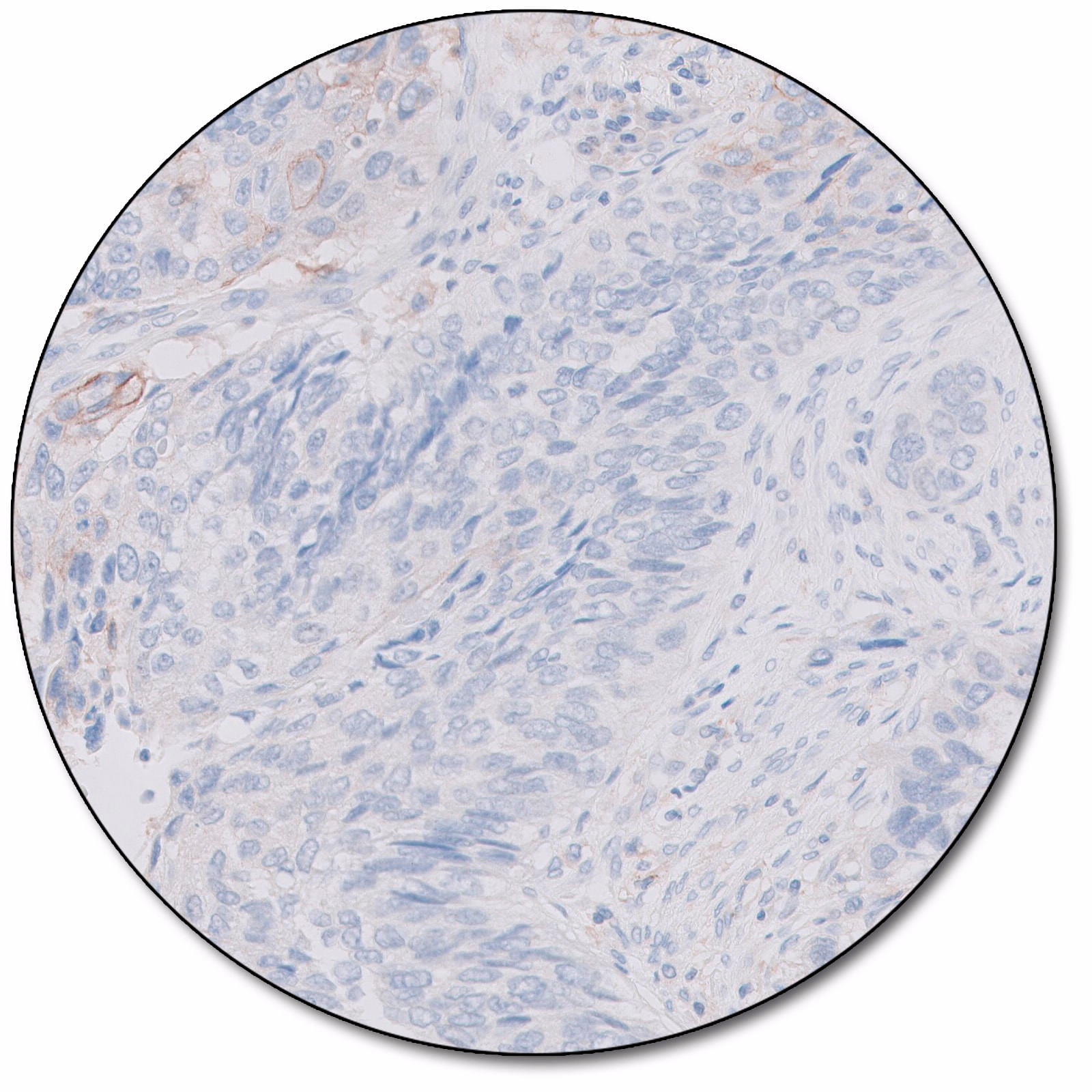 PD-L1 IHC 28-8 pharmDx for Autostainer Link 48